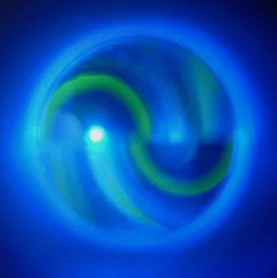 Investigação e acompanhamento de glaucoma (casos não cirúrigicos)